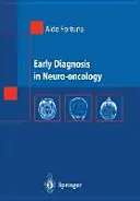 Korai diagnózis az ideg-onkológiában - Early Diagnosis in Neuro-Oncology