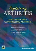 Az ízületi gyulladás magyarázata - Élet az ízületi gyulladással és annak kezelése - Explaining Arthritis - Living With and Controlling Arthritis