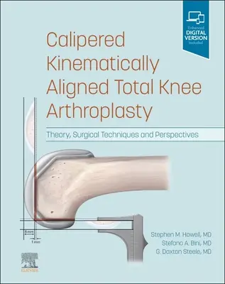 Kalipered Kinematically Aligned Total Knee Arthroplastica: Elmélet, műtéti technikák és perspektívák - Calipered Kinematically Aligned Total Knee Arthroplasty: Theory, Surgical Techniques and Perspectives