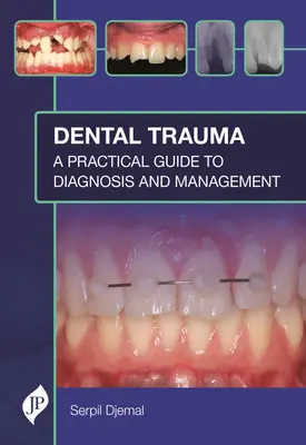 Fogászati trauma: Gyakorlati útmutató a diagnózishoz és kezeléshez - Dental Trauma: A Practical Guide to Diagnosis and Management