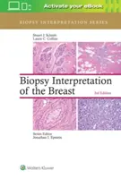 Az emlő biopszia-értelmezése - Biopsy Interpretation of the Breast