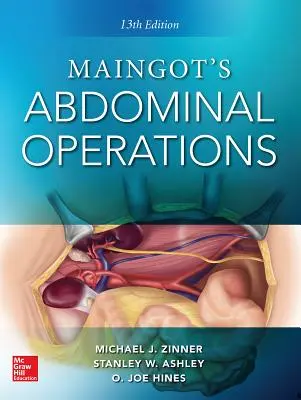 Maingot hasi műtétei. 13. kiadás - Maingot's Abdominal Operations. 13th Edition