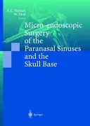 A melléküregek és a koponyaalap mikro-endoszkópos sebészete - Micro-Endoscopic Surgery of the Paranasal Sinuses and the Skull Base