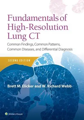 A nagyfelbontású tüdő CT alapjai: gyakori leletek, gyakori minták, gyakori betegségek és differenciáldiagnózis - Fundamentals of High-Resolution Lung CT: Common Findings, Common Patterns, Common Diseases and Differential Diagnosis