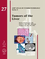 A máj daganatai - Tumors of the Liver