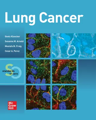 Tüdőrák: A tüdőgyógyászat: Az ellátás standardjai - Lung Cancer: Standards of Care