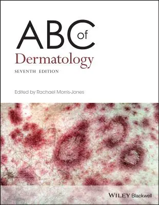 A bőrgyógyászat ABC-je - ABC of Dermatology