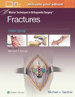 Mestertechnikák az ortopédiai sebészetben: Törések - Master Techniques in Orthopaedic Surgery: Fractures