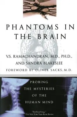 Fantomok az agyban - Phantoms in the Brain