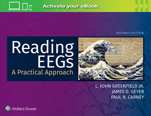 EEG-k olvasása: Gyakorlati megközelítés - Reading Eegs: A Practical Approach