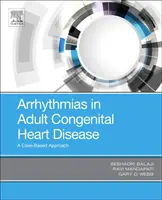 Arrhythmiák a felnőttkori veleszületett szívbetegségekben: A Case-Based Approach - Arrhythmias in Adult Congenital Heart Disease: A Case-Based Approach