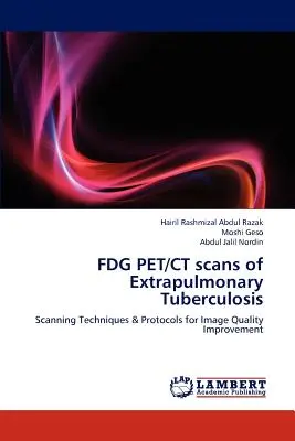 Az extrapulmonális tuberkulózis FDG PET/CT-vizsgálata - FDG PET/CT scans of Extrapulmonary Tuberculosis