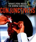 Amit a kötőhártya-gyulladásról tudni kell - What You Need to Know about Conjunctivitis