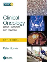 Klinikai onkológia: Alapelvek és gyakorlat - Clinical Oncology: Basic Principles and Practice