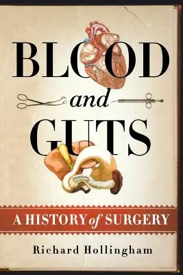 Vér és belek: A sebészet története - Blood and Guts: A History of Surgery