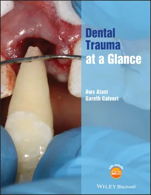 Fogászati trauma egy pillantásra - Dental Trauma at a Glance