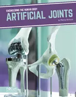 Mesterséges ízületek - Artificial Joints