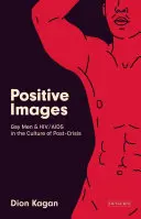 Pozitív képek: Meleg férfiak és a HIV/AIDS a „válság utáni” kultúrában - Positive Images: Gay Men and Hiv/AIDS in the Culture of 'Post Crisis'