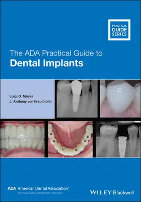 Az ADA gyakorlati útmutató a fogászati implantátumokhoz - The ADA Practical Guide to Dental Implants