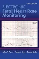 Elektronikus magzati szívfrekvencia-monitorozás: Az 5-szintű rendszer: Az 5-szintű rendszer - Electronic Fetal Heart Rate Monitoring: The 5-Tier System: The 5-Tier System