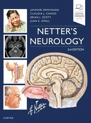 Netter neurológiája - Netter's Neurology