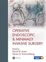 Operatív endoszkópos és minimálisan invazív sebészet - Operative Endoscopic and Minimally Invasive Surgery