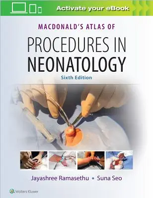 Macdonald's Atlas of Procedures in Neonatology (A neonatológiai eljárások atlasza) - Macdonald's Atlas of Procedures in Neonatology