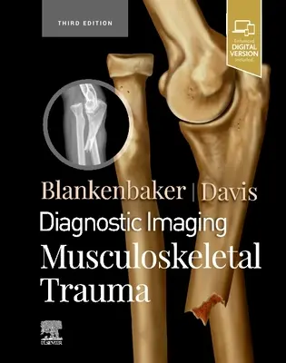 Diagnosztikai képalkotás: Musculoskeletal Trauma - Diagnostic Imaging: Musculoskeletal Trauma