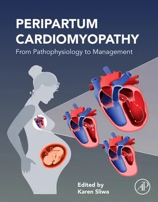 Peripartum kardiomiopátia: A patofiziológiától a kezelésig - Peripartum Cardiomyopathy: From Pathophysiology to Management