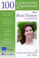 100 kérdés és válasz az agydaganatokról - 100 Questions  &  Answers About Brain Tumors