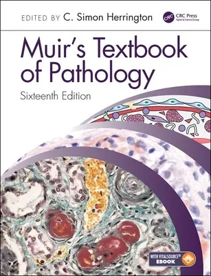 Muir patológiai tankönyve - Muir's Textbook of Pathology