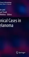 A melanoma klinikai esetei - Clinical Cases in Melanoma