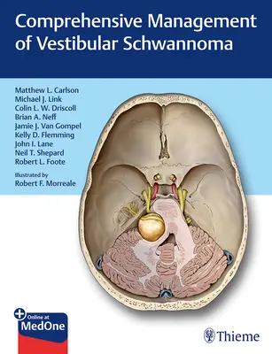 A vestibularis schwannoma átfogó kezelése - Comprehensive Management of Vestibular Schwannoma