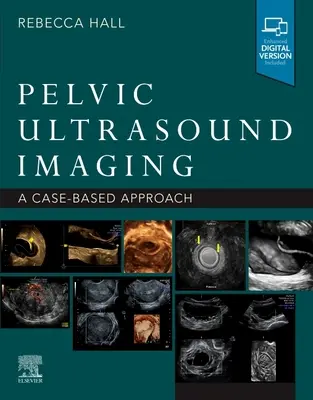 Kismedencei ultrahangos képalkotás: A Cased-Based Approach - Pelvic Ultrasound Imaging: A Cased-Based Approach