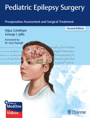 Gyermekkori epilepsziás sebészet: A műtét előtti értékelés és sebészeti kezelés - Pediatric Epilepsy Surgery: Preoperative Assessment and Surgical Treatment