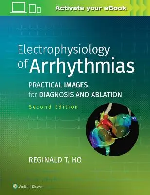 Az aritmiák elektrofiziológiája: Gyakorlati képek a diagnózishoz és az ablációhoz - Electrophysiology of Arrhythmias: Practical Images for Diagnosis and Ablation