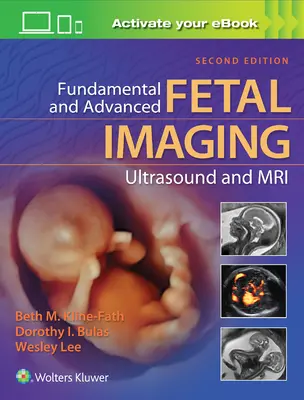 Alapvető és haladó magzati képalkotás Ultrahang és MRI - Fundamental and Advanced Fetal Imaging Ultrasound and MRI