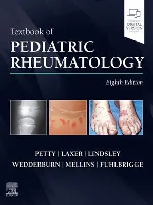 A gyermekreumatológia tankönyve - Textbook of Pediatric Rheumatology