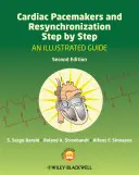 Szívritmus-szabályozók és reszinkronizáció lépésről lépésre: Egy illusztrált útmutató - Cardiac Pacemakers and Resynchronization Step by Step: An Illustrated Guide