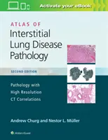 Az interstitiális tüdőbetegségek patológiájának atlasza - Atlas of Interstitial Lung Disease Pathology