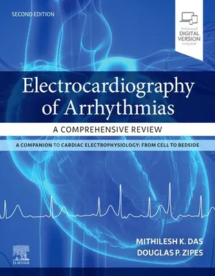 Az aritmiák elektrokardiográfiája: Átfogó áttekintés - Electrocardiography of Arrhythmias: A Comprehensive Review