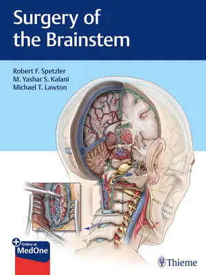 Az agytörzs sebészete - Surgery of the Brainstem