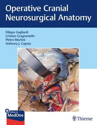 Operatív koponya idegsebészeti anatómia - Operative Cranial Neurosurgical Anatomy