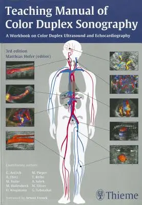 A színes duplex szonográfia oktatási kézikönyve - Teaching Manual of Color Duplex Sonography