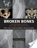 Törött csontok: A törések és ficamok radiológiai atlasza - Broken Bones: The Radiologic Atlas of Fractures and Dislocations