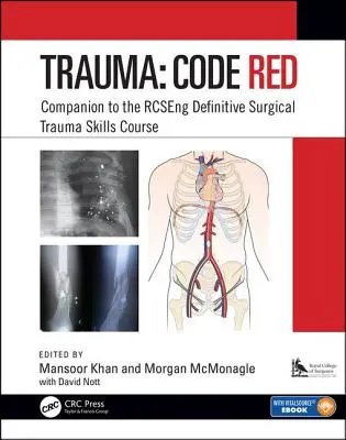 Trauma: Vörös kód: Rcseng Definitive Surgical Trauma Skills Course: Companion to the Rcseng Definitive Surgical Trauma Skills Course - Trauma: Code Red: Companion to the Rcseng Definitive Surgical Trauma Skills Course