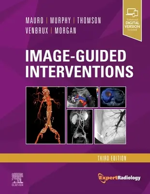 Képvezérelt beavatkozások: Radiológiai szakértői sorozat - Image-Guided Interventions: Expert Radiology Series