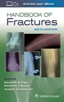 A törések kézikönyve - Handbook of Fractures