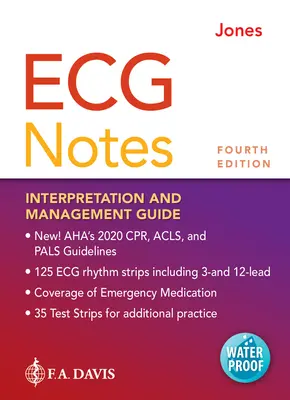 EKG Notes: Értelmezési és kezelési útmutató - ECG Notes: Interpretation and Management Guide