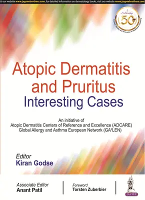 Atópiás bőrgyulladás és viszketés - Atopic Dermatitis and Pruritus